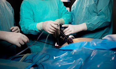 Reasons To Choose Laparoscopic Surgery
