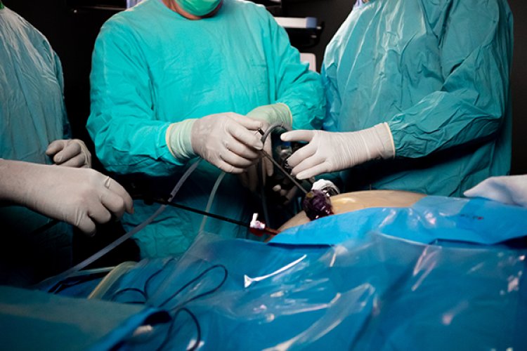 Reasons To Choose Laparoscopic Surgery