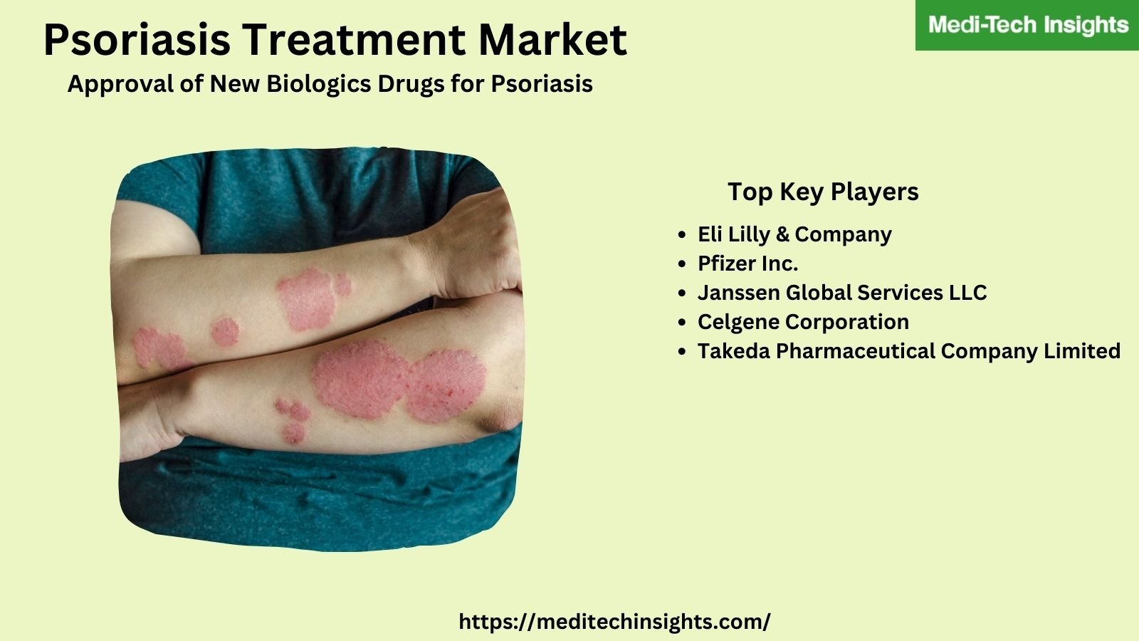 Global Psoriasis Treatment Market is anticipated to grow at a CAGR of ~8.5% by 2026