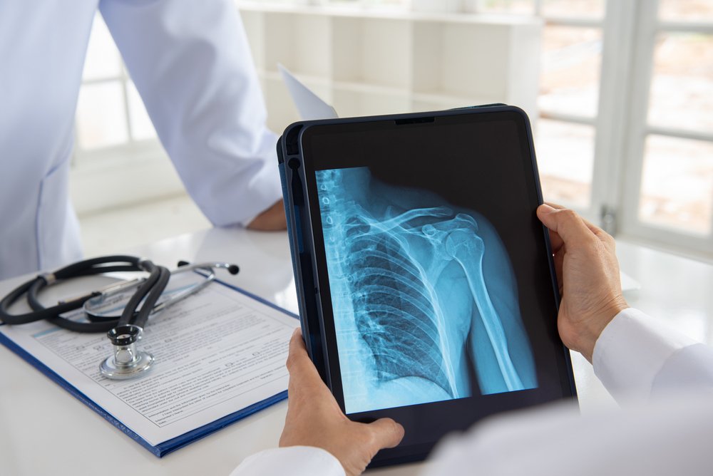 What is Digital X-Ray and Portable X-Ray